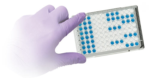 Estradiol (E2) ELISA